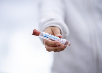 Region płocki: 30 potwierdzonych nowych przypadków zakażenia. Zbliżamy się do żółtej strefy?