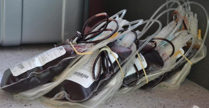 Ważny apel do osób, które przeszły zakażenie koronawirusem