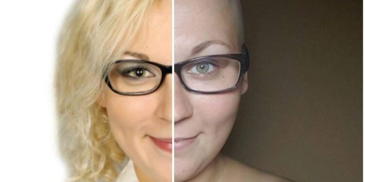 Pomaga innym, nie zważając na chorobę. Teraz sama potrzebuje pomocy!