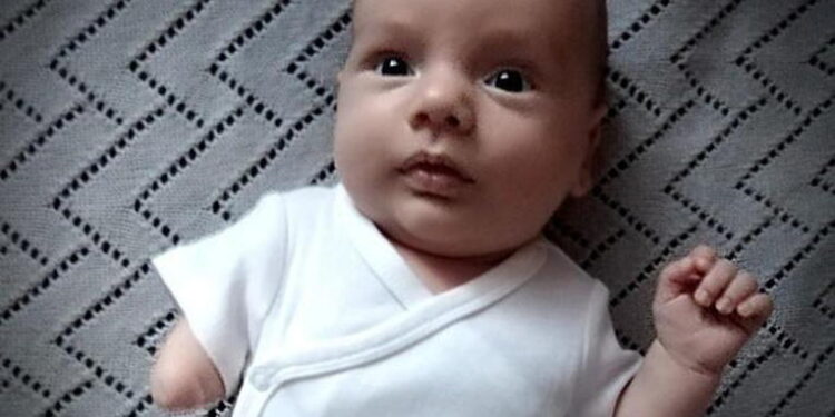 Czteromiesięczy Maks bardzo potrzebuje pomocnej dłoni…